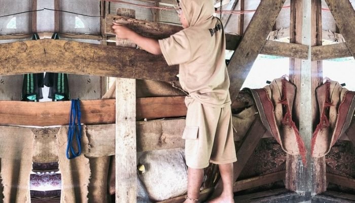 Ikatan Kasih: Kisah Habibi, Bocah Pengidap Hidrosefalus yang Terpaksa Diikat